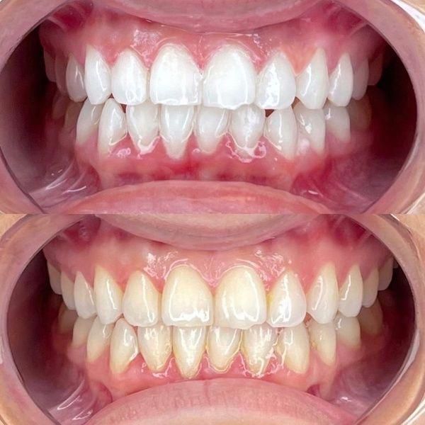 Gloria Haydee Castillo Castellanos-17