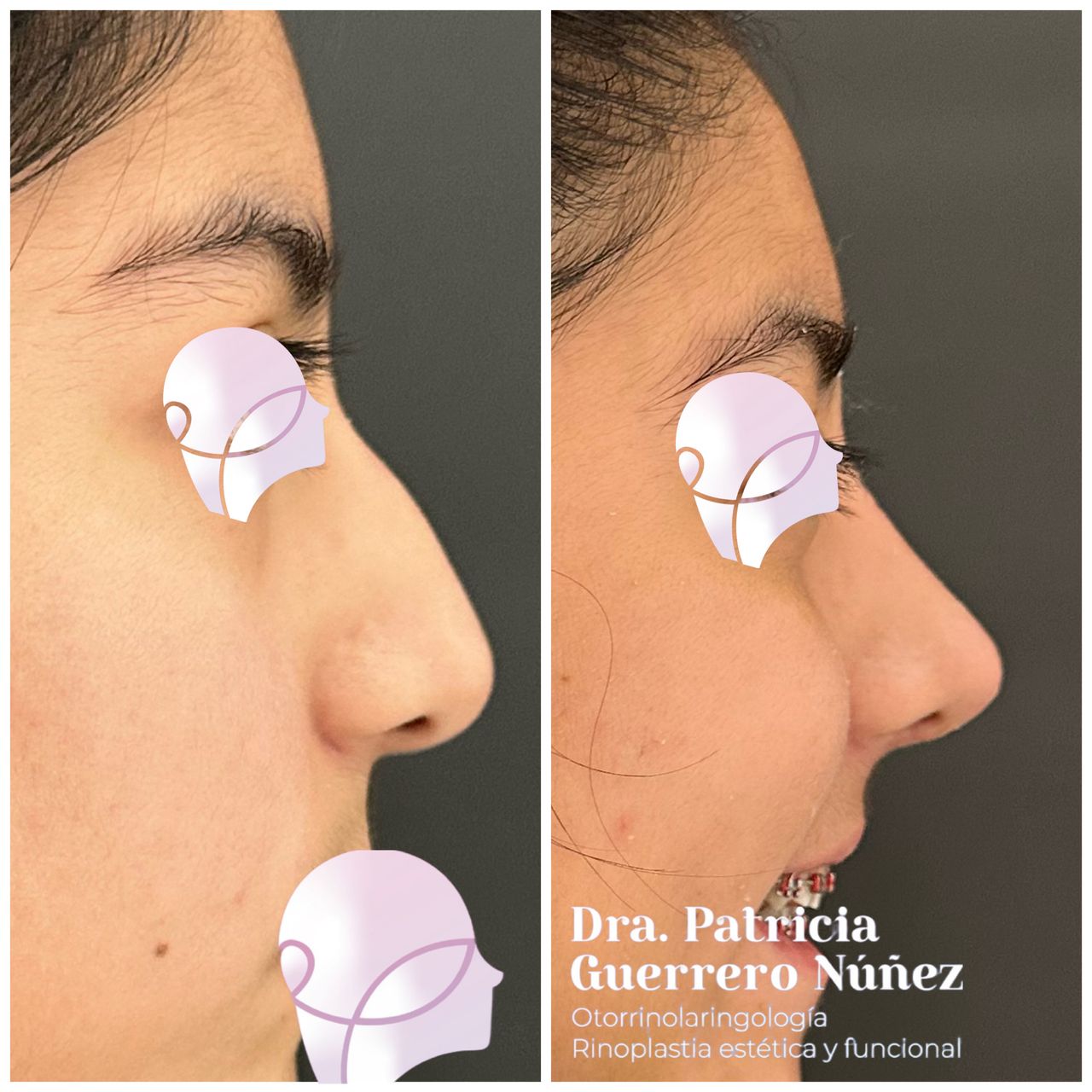 Patricia Guerrero-5