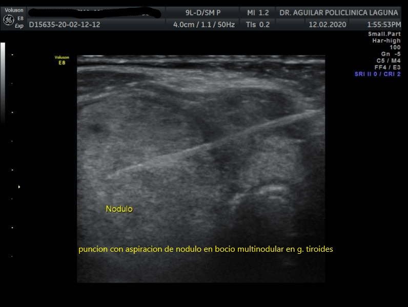 Edgar Fernando Aguilar Morales-7