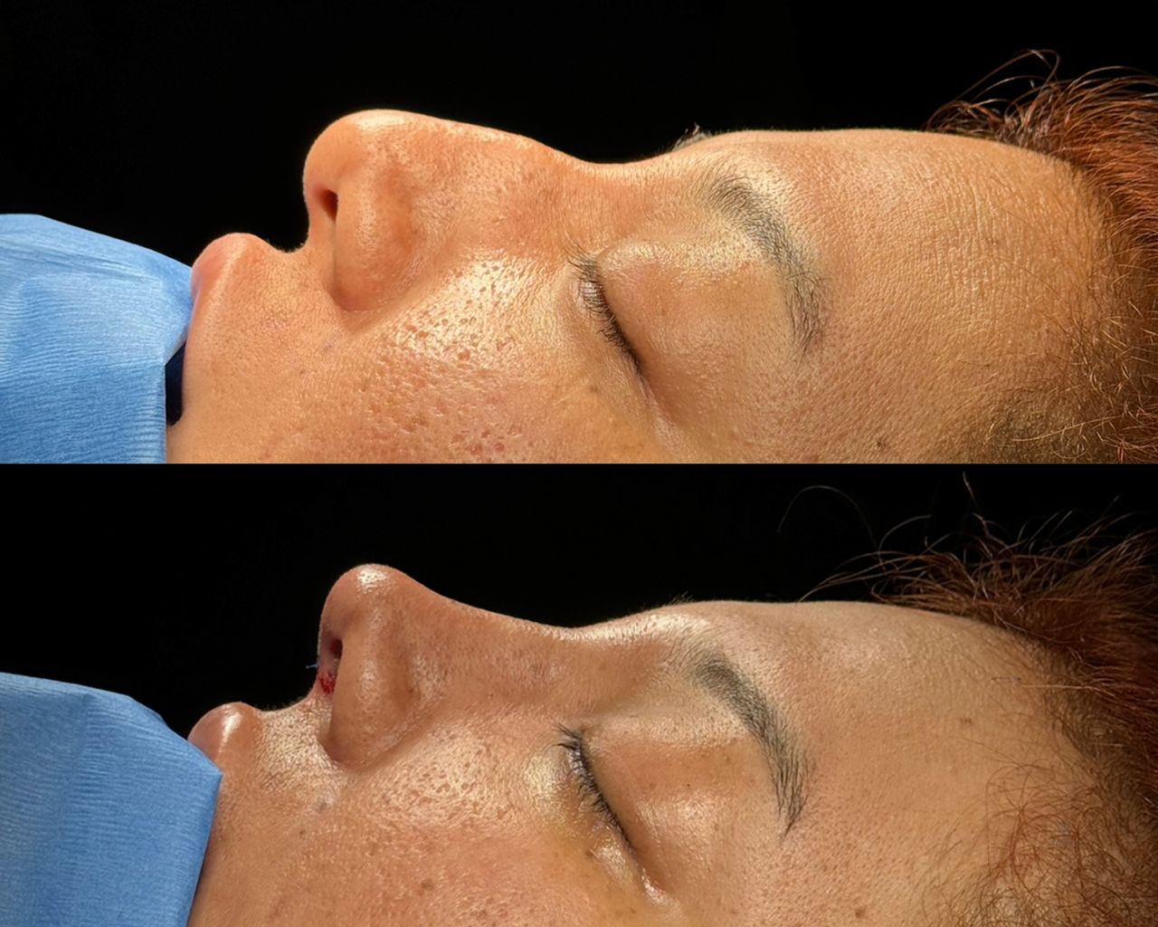 Angel Castro Urquizo-63