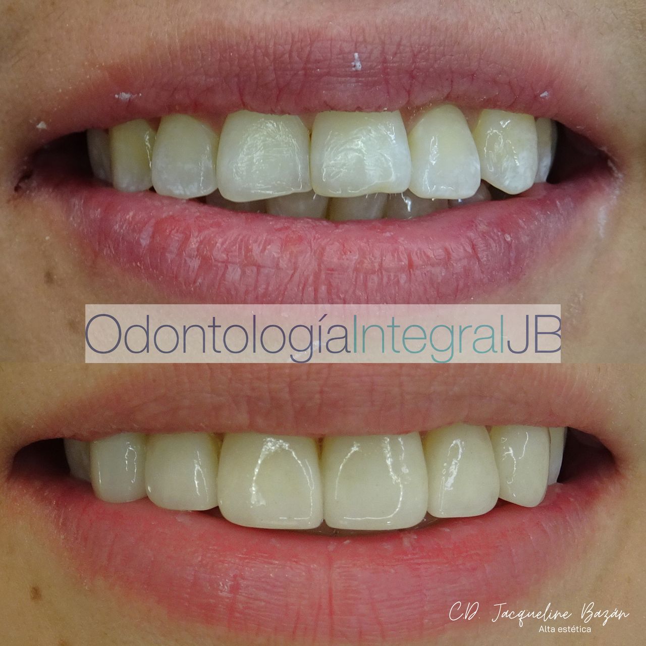 Jacqueline Bazán Díaz-5