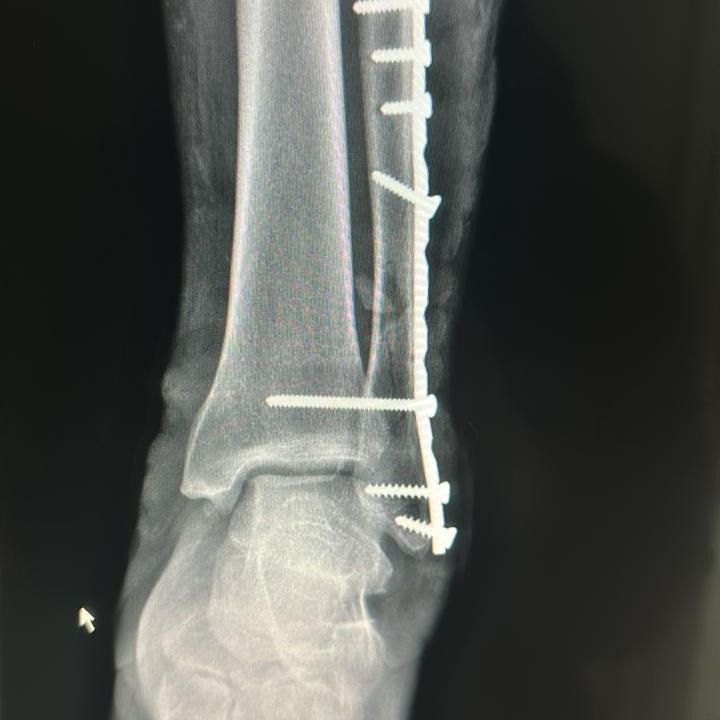 Max Georges Sainte Bernal-10