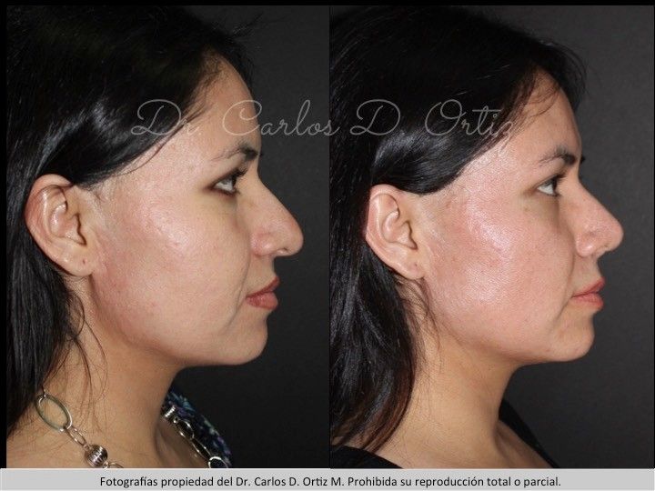 Carlos David Ortiz Moreno-24