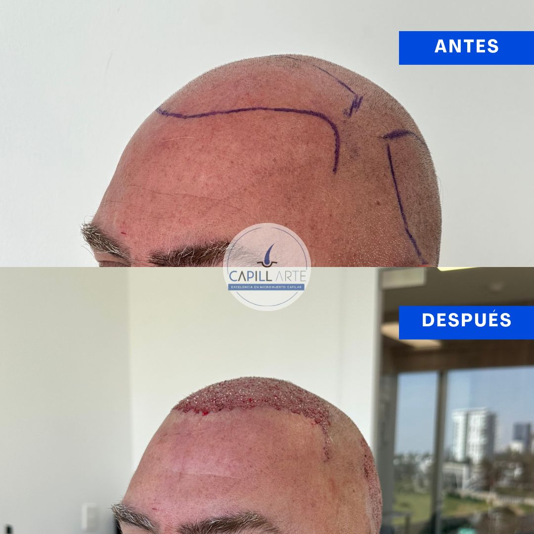 Adrian Hernandez Lopez-37