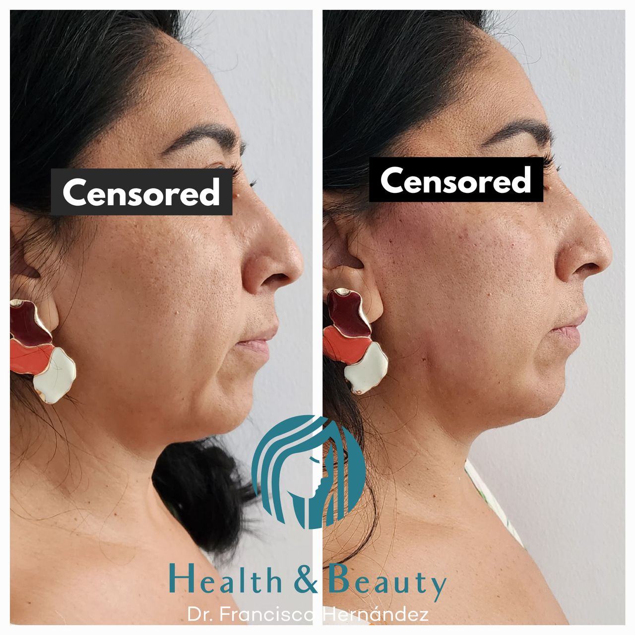 Francisco Hernández Gómez Crespo-36