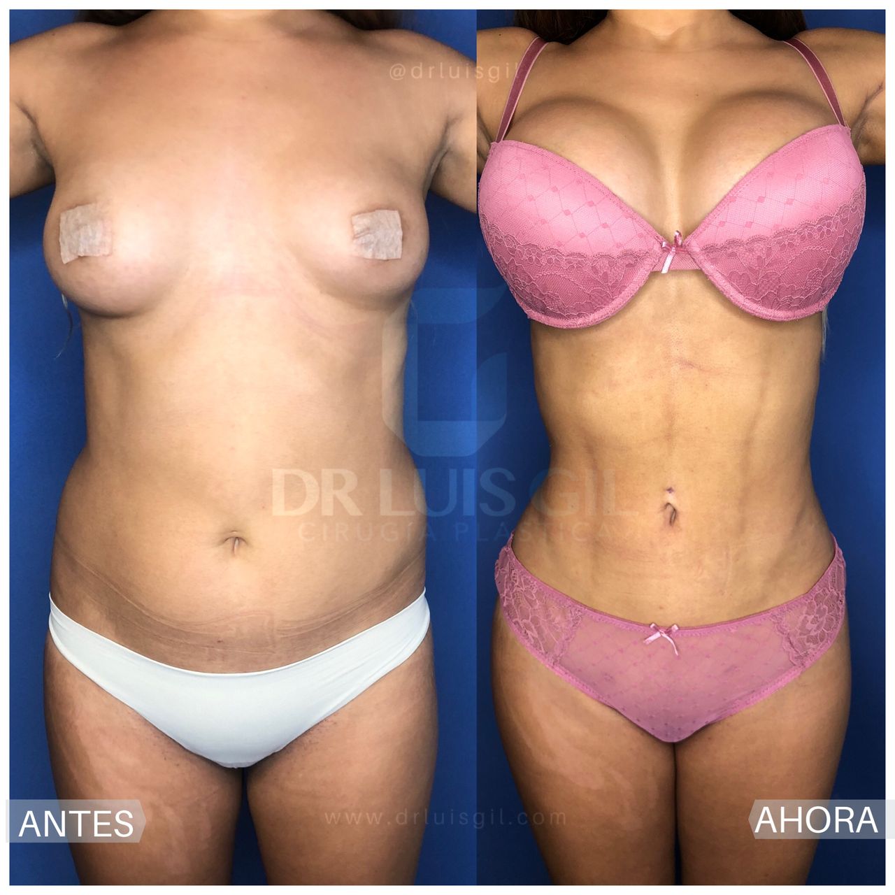 Luis Atilio Gil Pérez-2