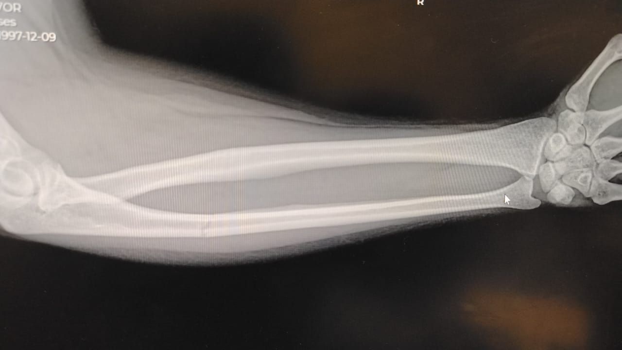 Alejandro Irisson-27