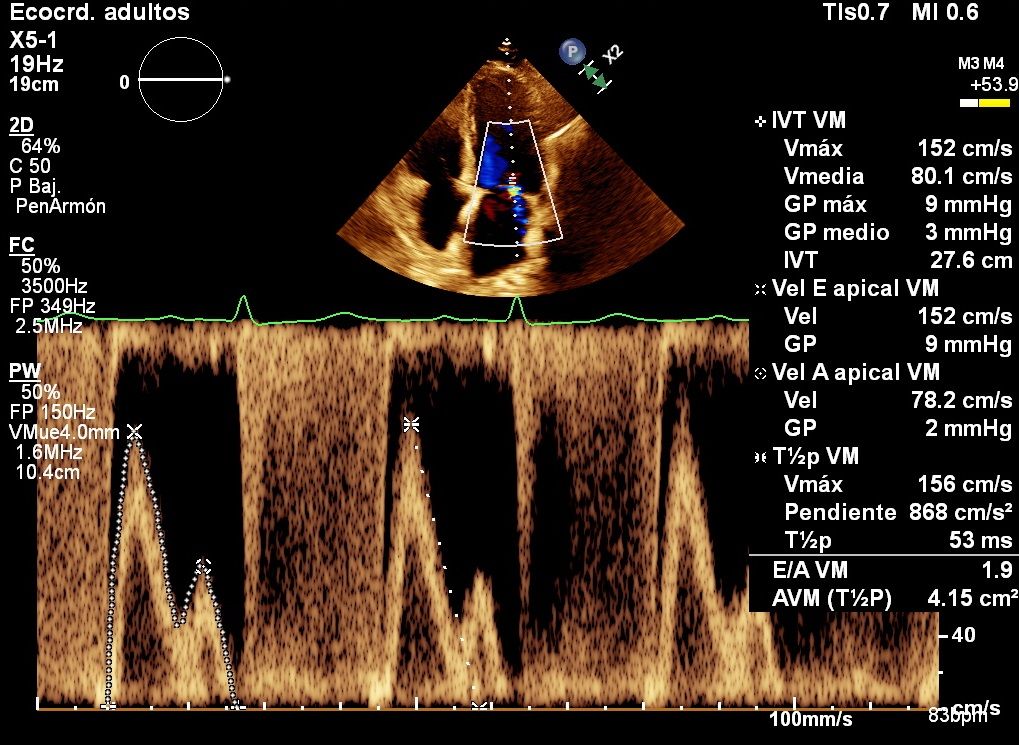 Heriberto Pruneda Ayala-8