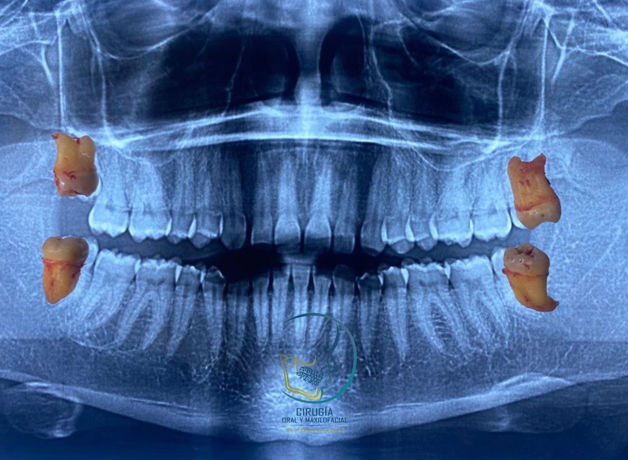 Roberto Garza Guerra-6