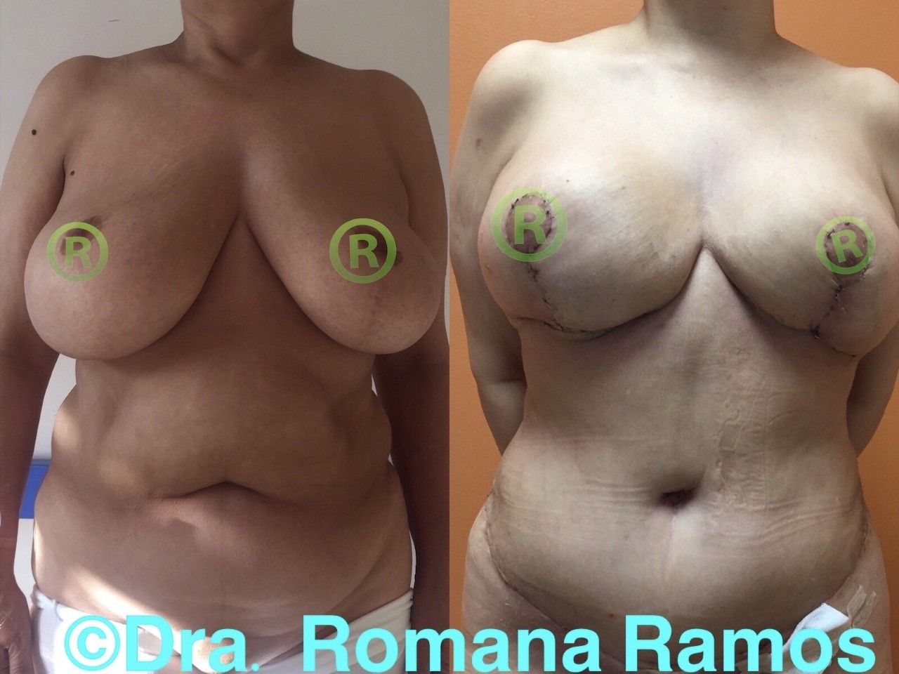 Romana Ramos Cárdenas-20