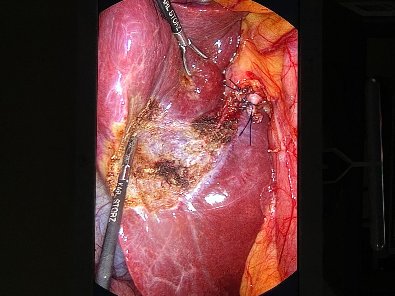 Ferstman Duran Hernandez-15