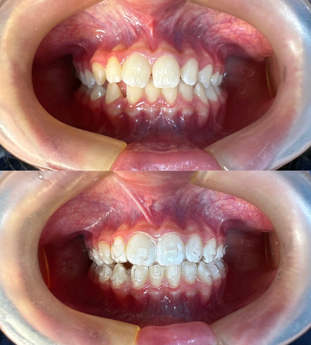 Heidi Mendoza Malagón-13