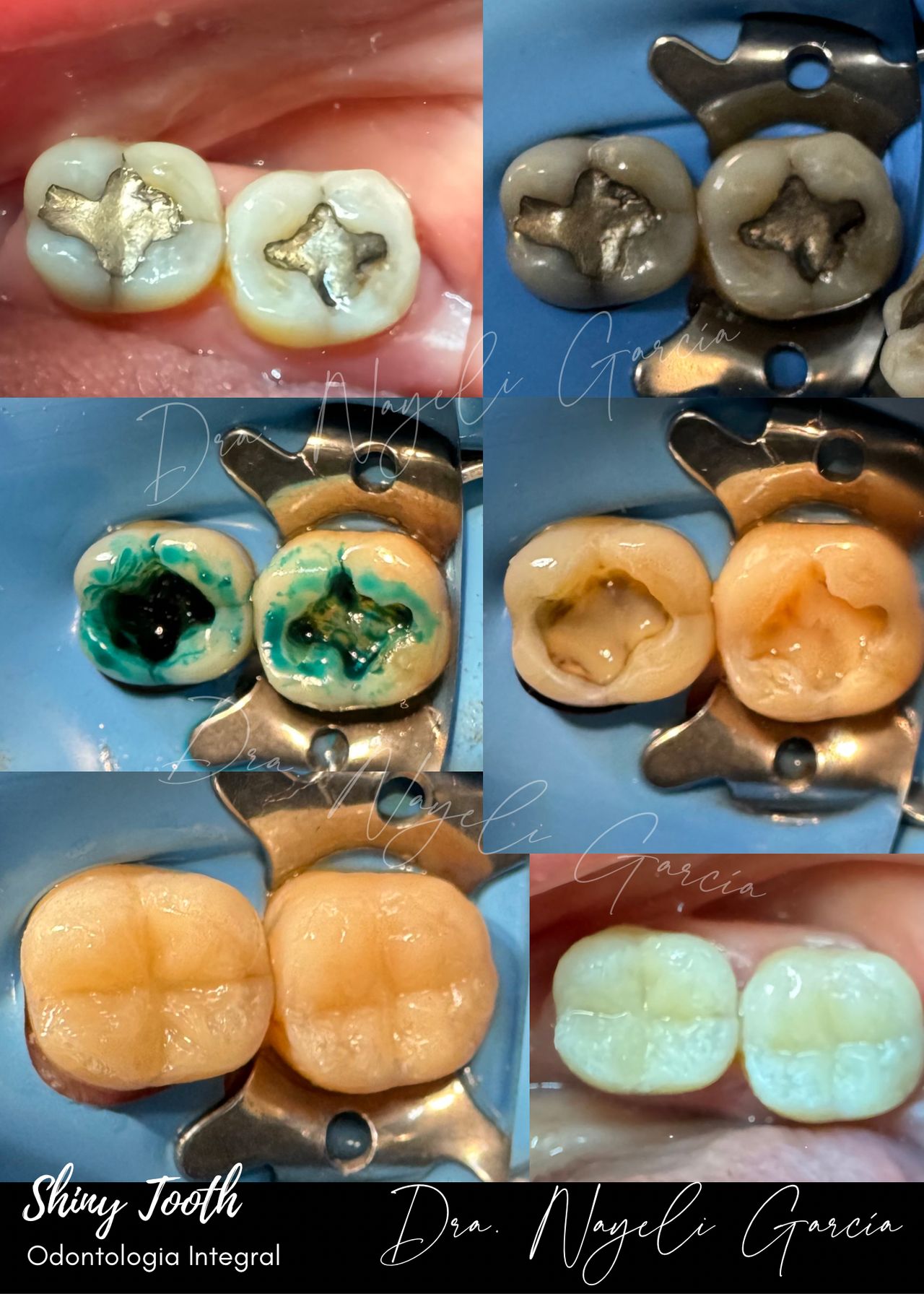 Nayeli Garcia Morales-22