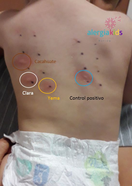 Herberth Pérez Avilés-3