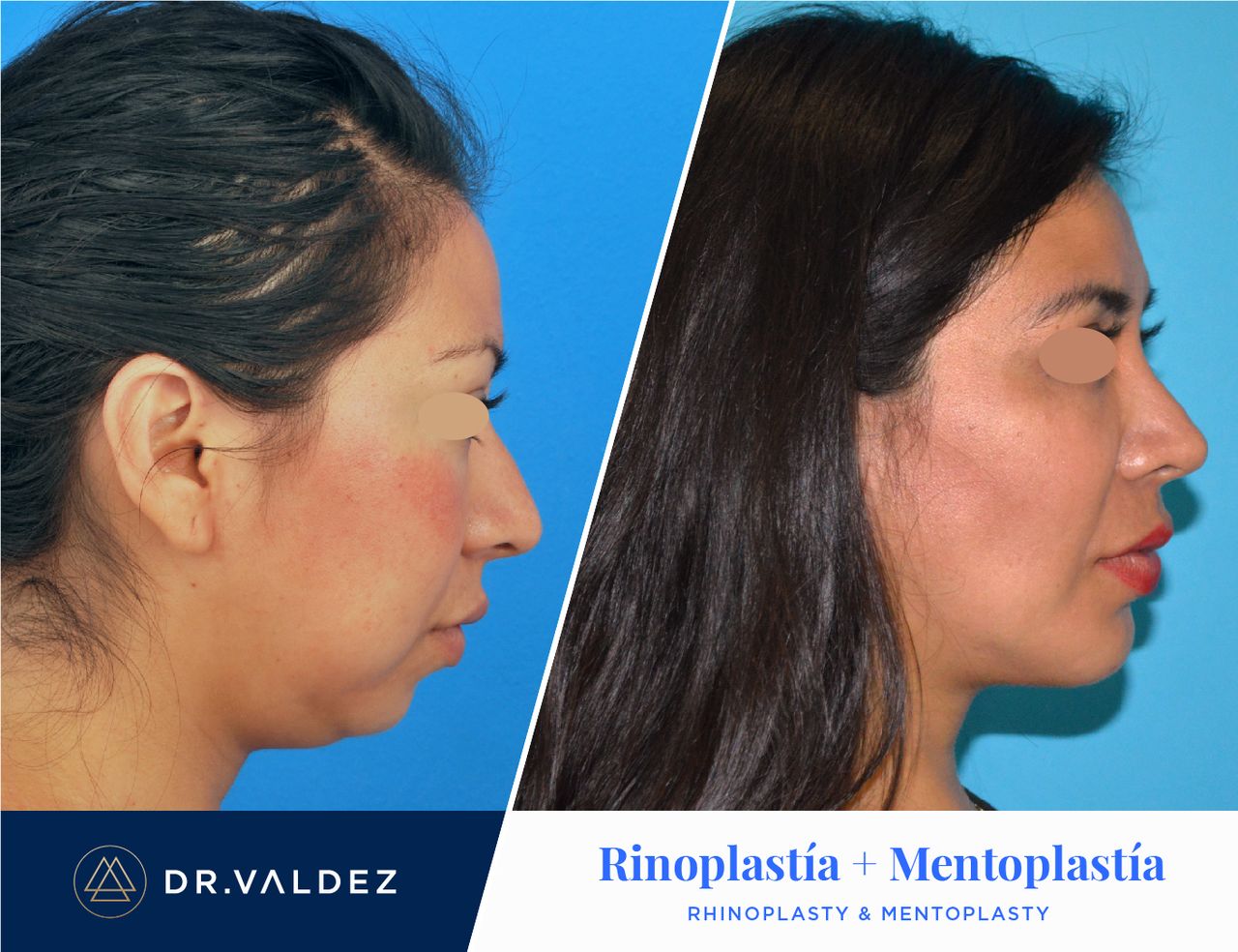 Pedro Arturo Valdez Gomez-5