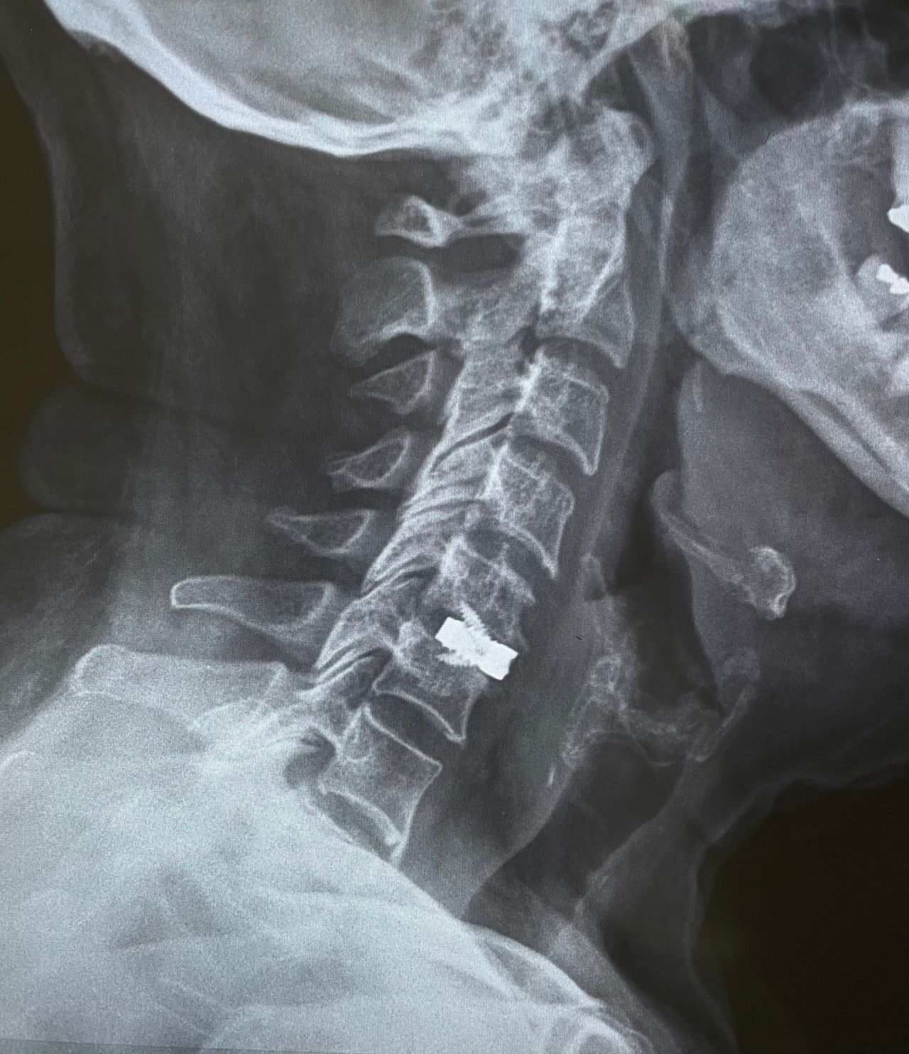 Celia Teresa De Jesús Álvarez Gamiño-12