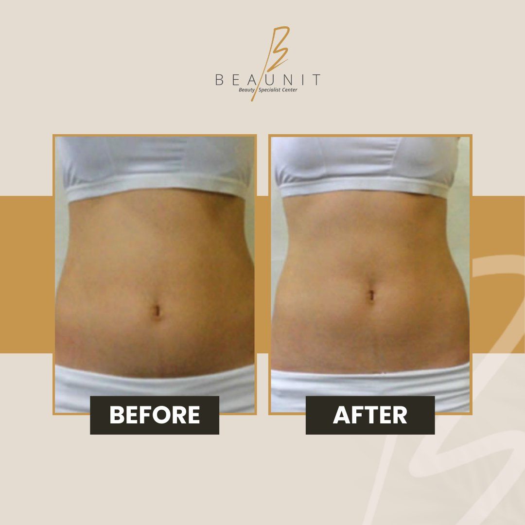 Gisel Areli Martinez Trejo-6