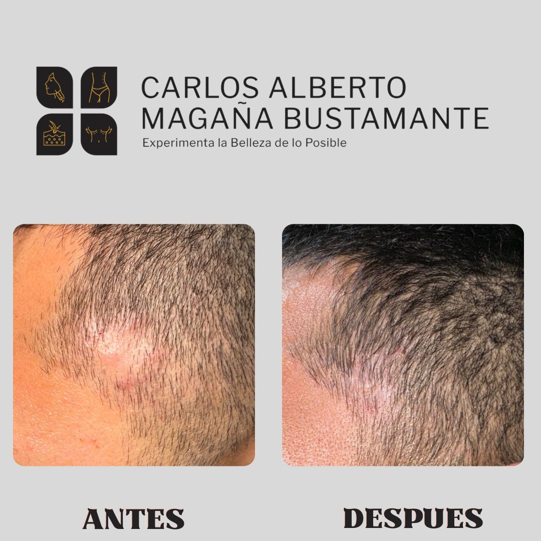 Carlos Alberto Magaña Bustamante-61