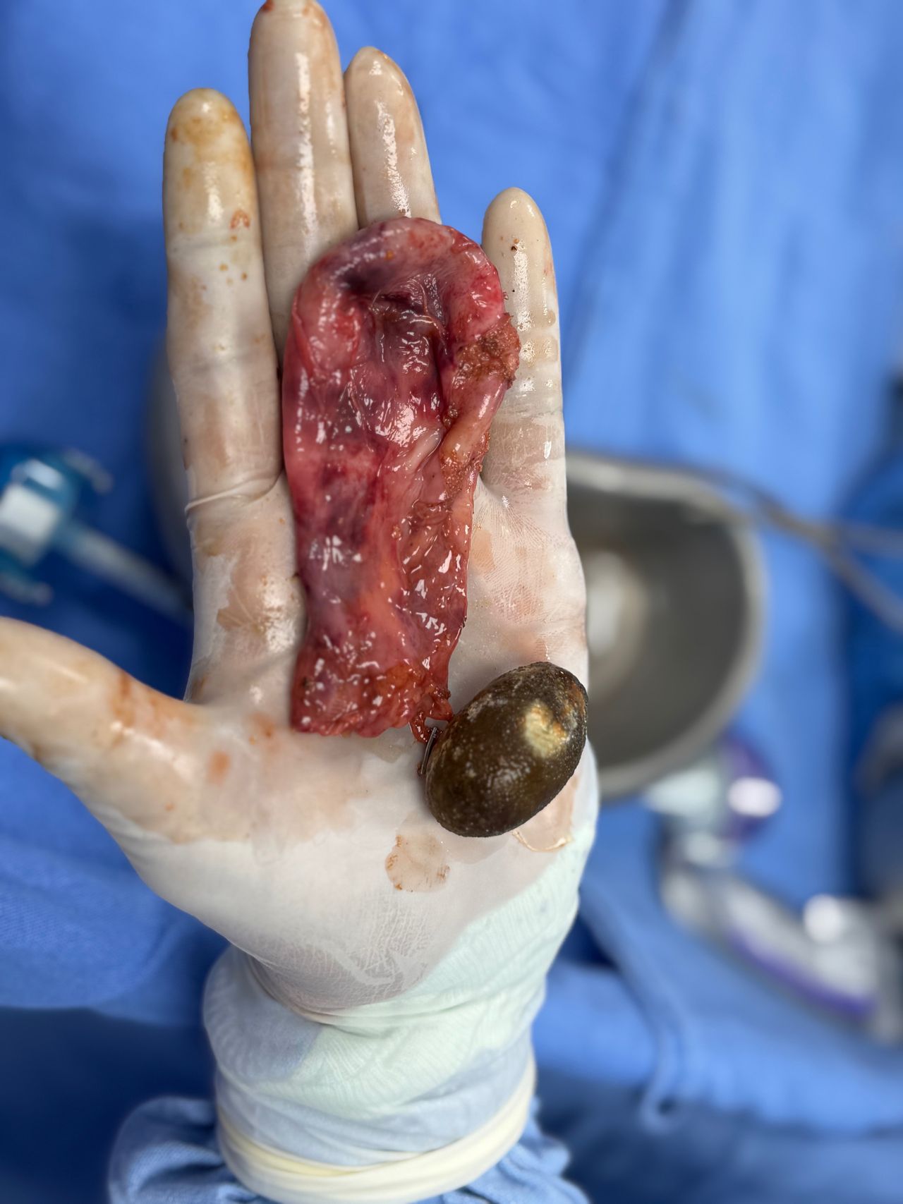 Isaalit Peñaloza Espinal-0