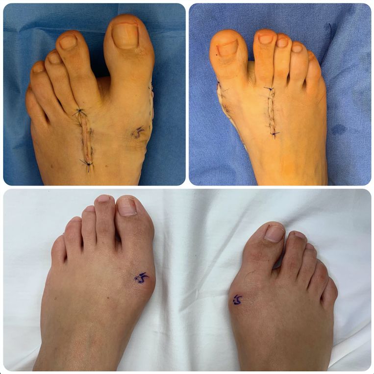 Luis Iram Lozano Parra-10