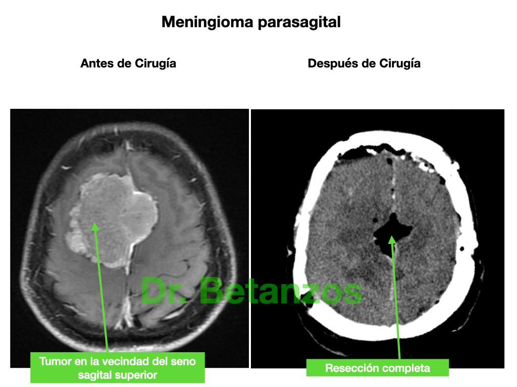 Aleixandre Betanzos Villegas-9