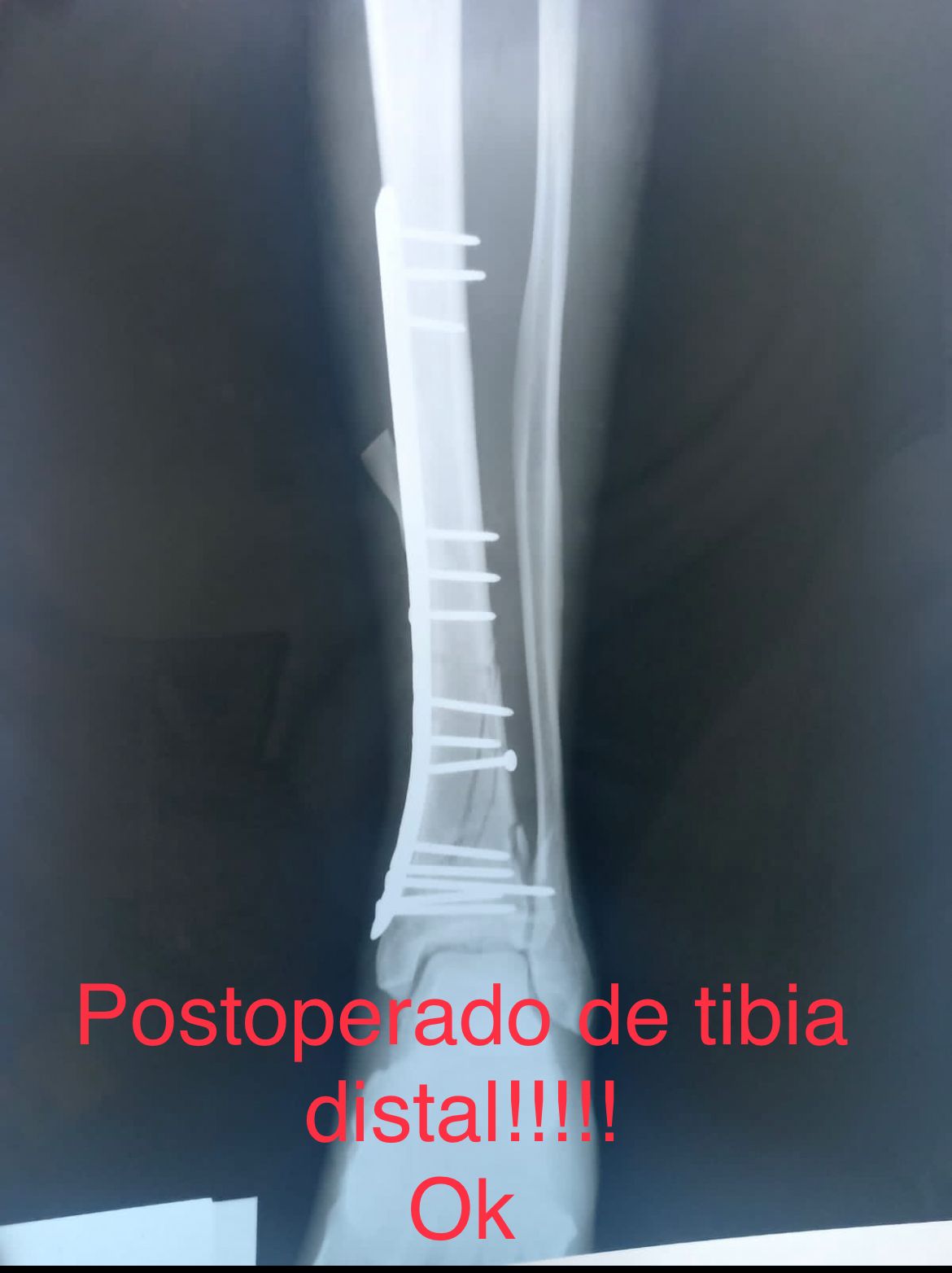 Emmanuel Bolaños Cortes-23