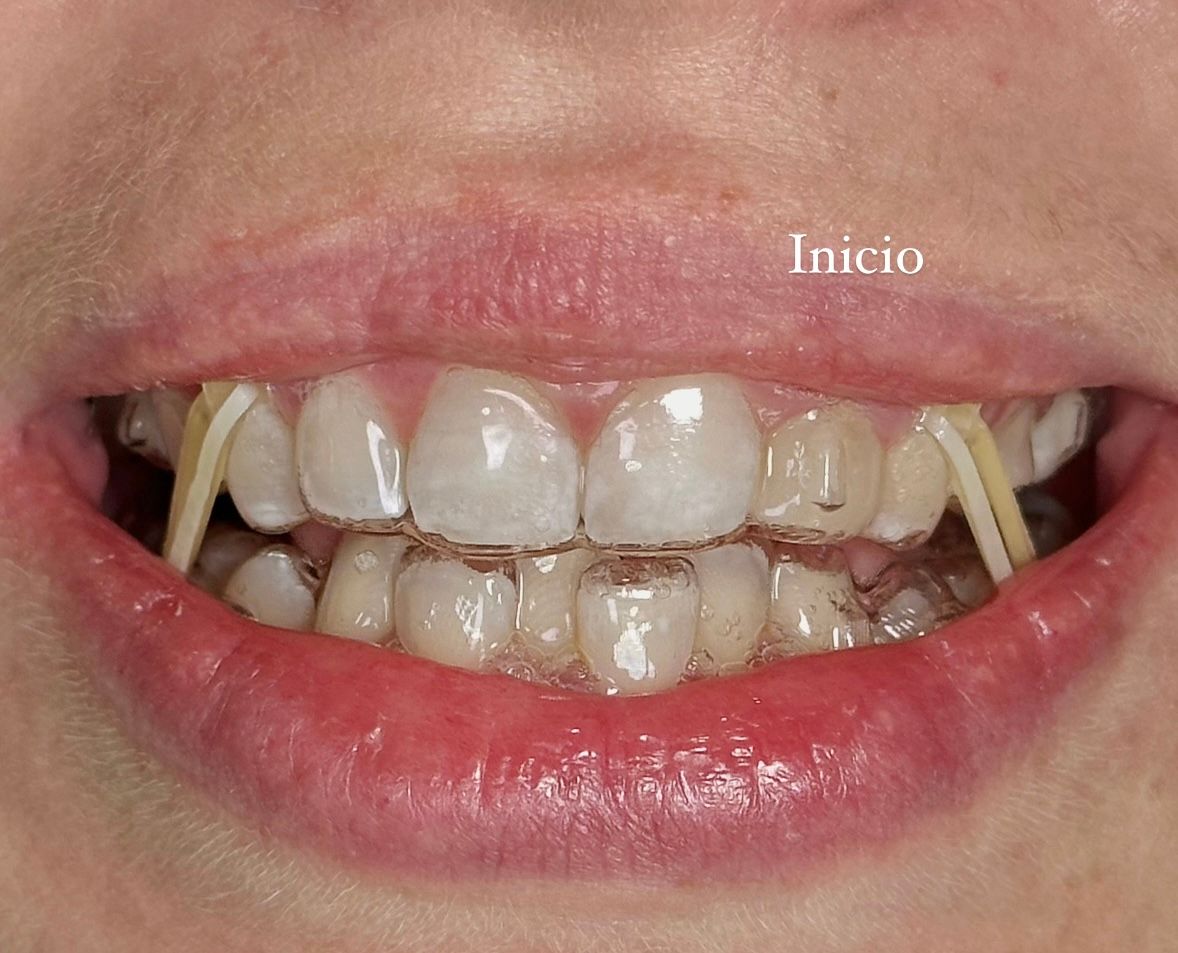 Angelica Najera Munguía-7