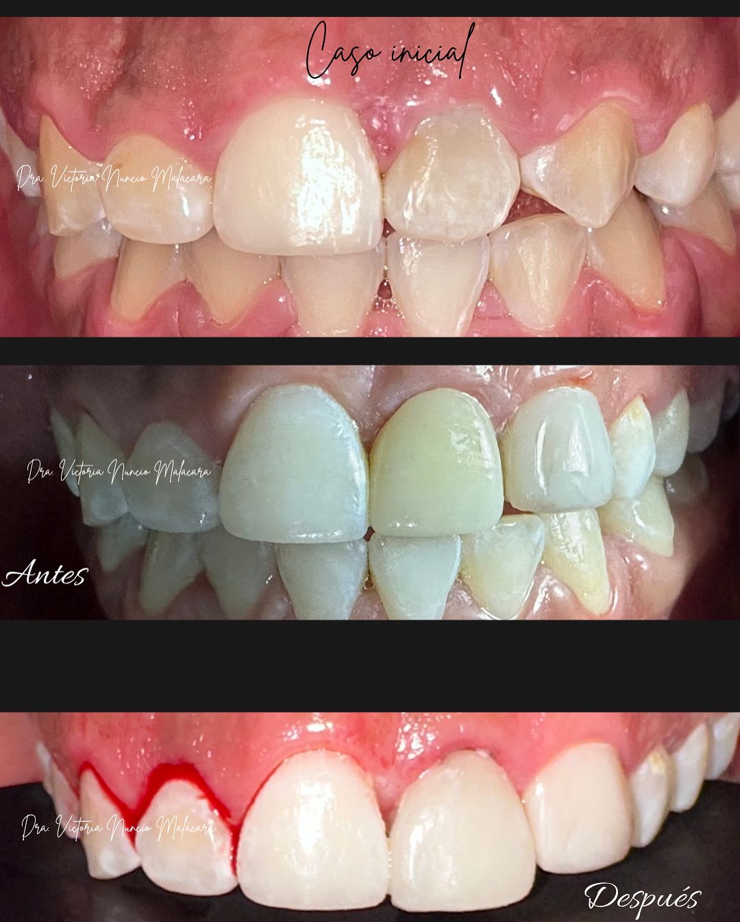 Victoria A. Nuncio Malacara-2