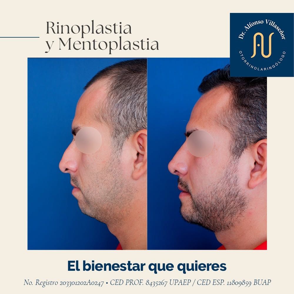 Alfonso Villaseñor Herrero-35