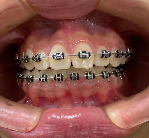 Carlos Ignacio Avila Campos-14