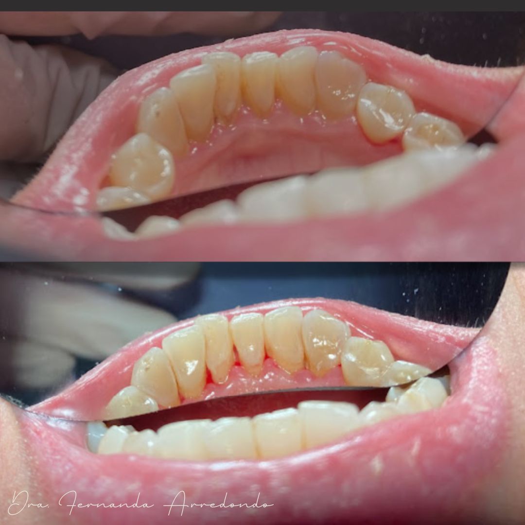 Fernanda Arredondo-2