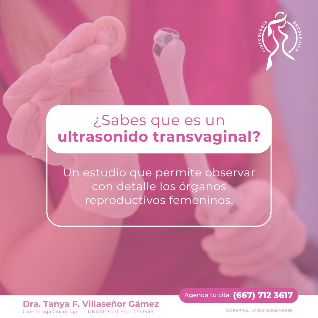 Tanya Fabiola Villaseñor Gámez-1