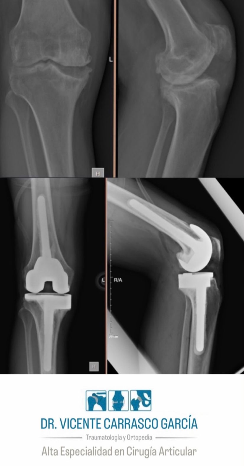 Vicente Carrasco García-9