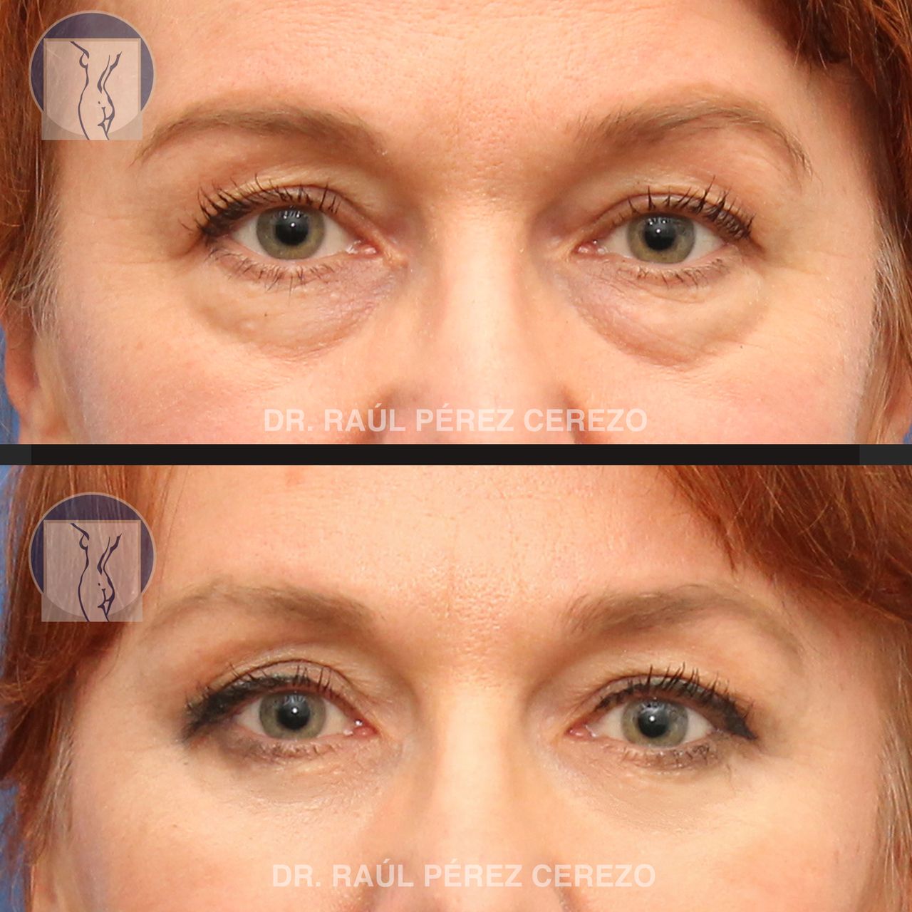 Raúl Pérez Cerezo-9