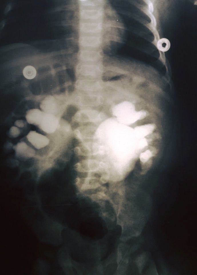 Héctor Iván Martínez López-19