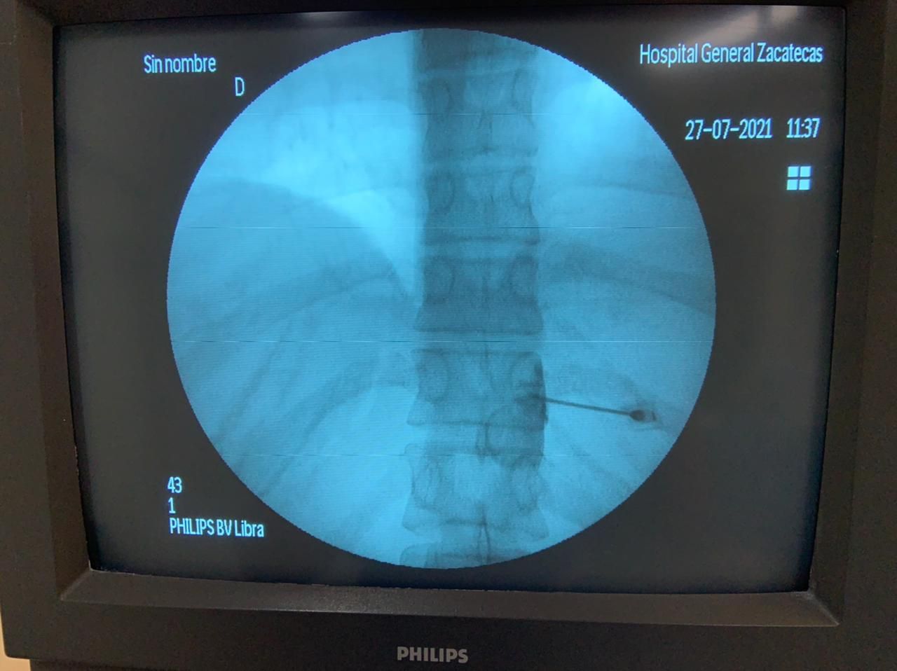 Liber Abdel Arenas Garcia-4