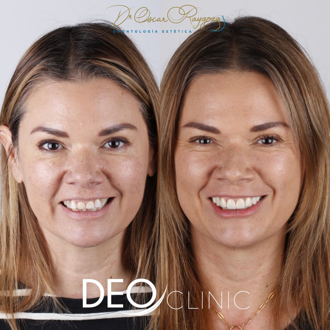 Oscar Raygoza Carrillo-23