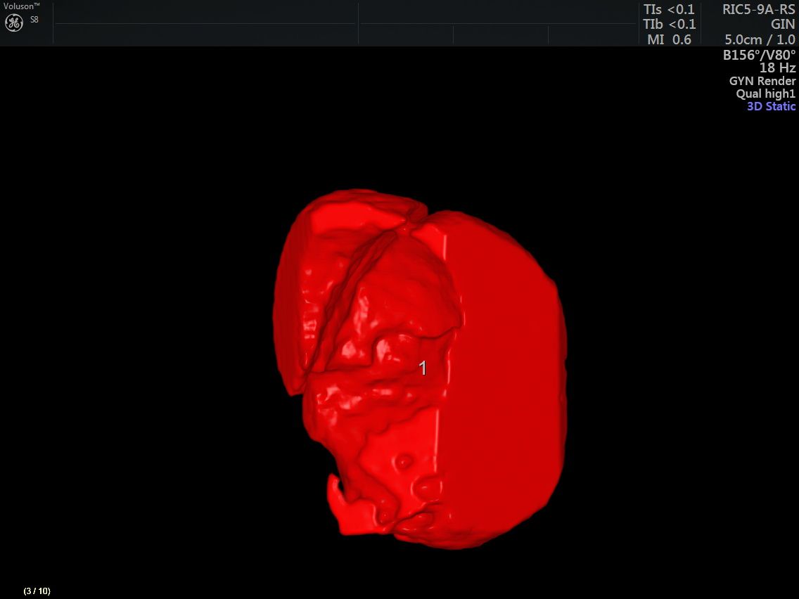 Griselda Reyes Torres-80