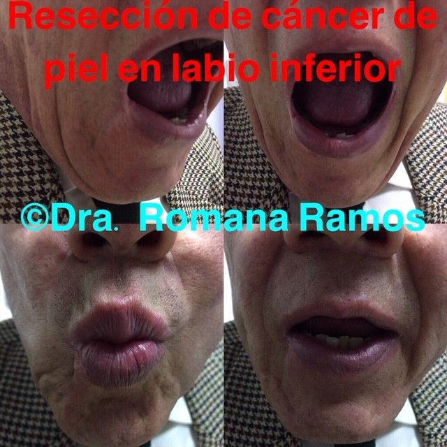 Romana Ramos Cárdenas-13