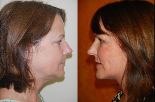 Edgar Ernesto Torres Mejía-29