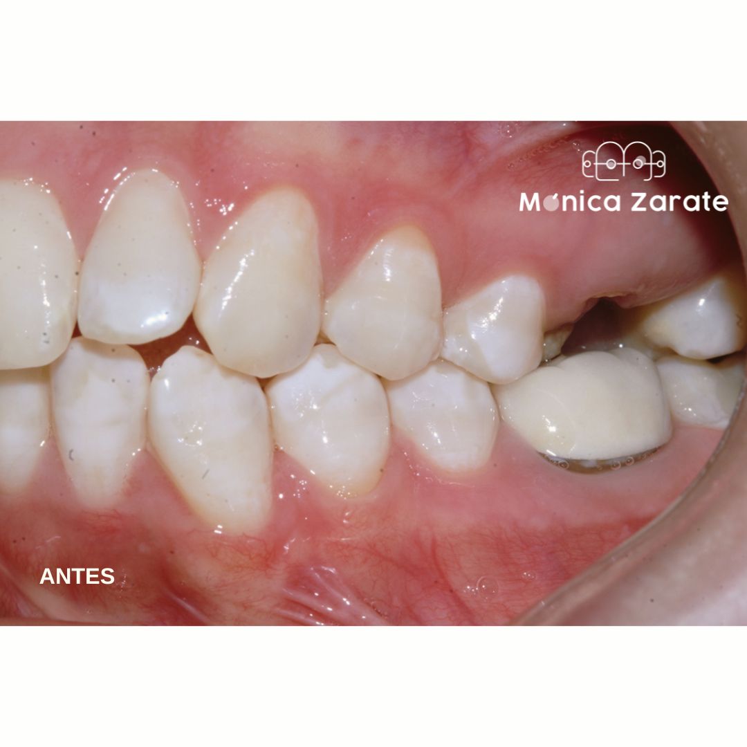 Mónica Isabel Zárate Pérez-11