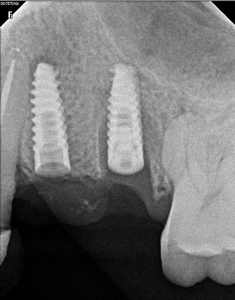 Jesus De La Cruz Ballinas-31