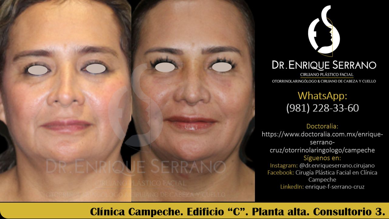 Enrique Serrano Cruz-59