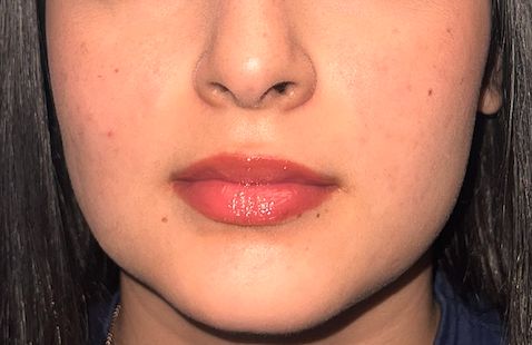 Lauro Francisco Varela Coronado-22