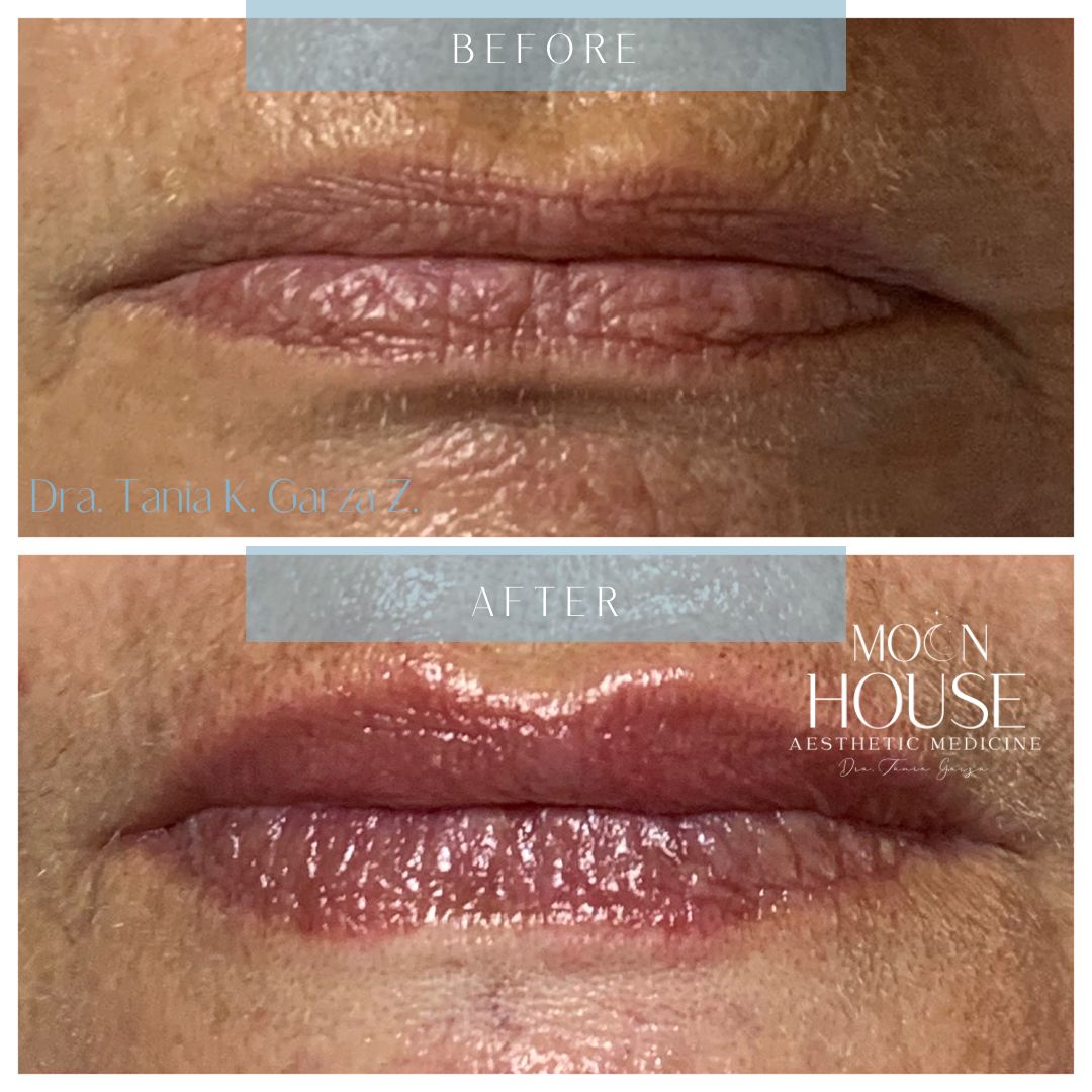 Tania Karine Garza Zepeda-17