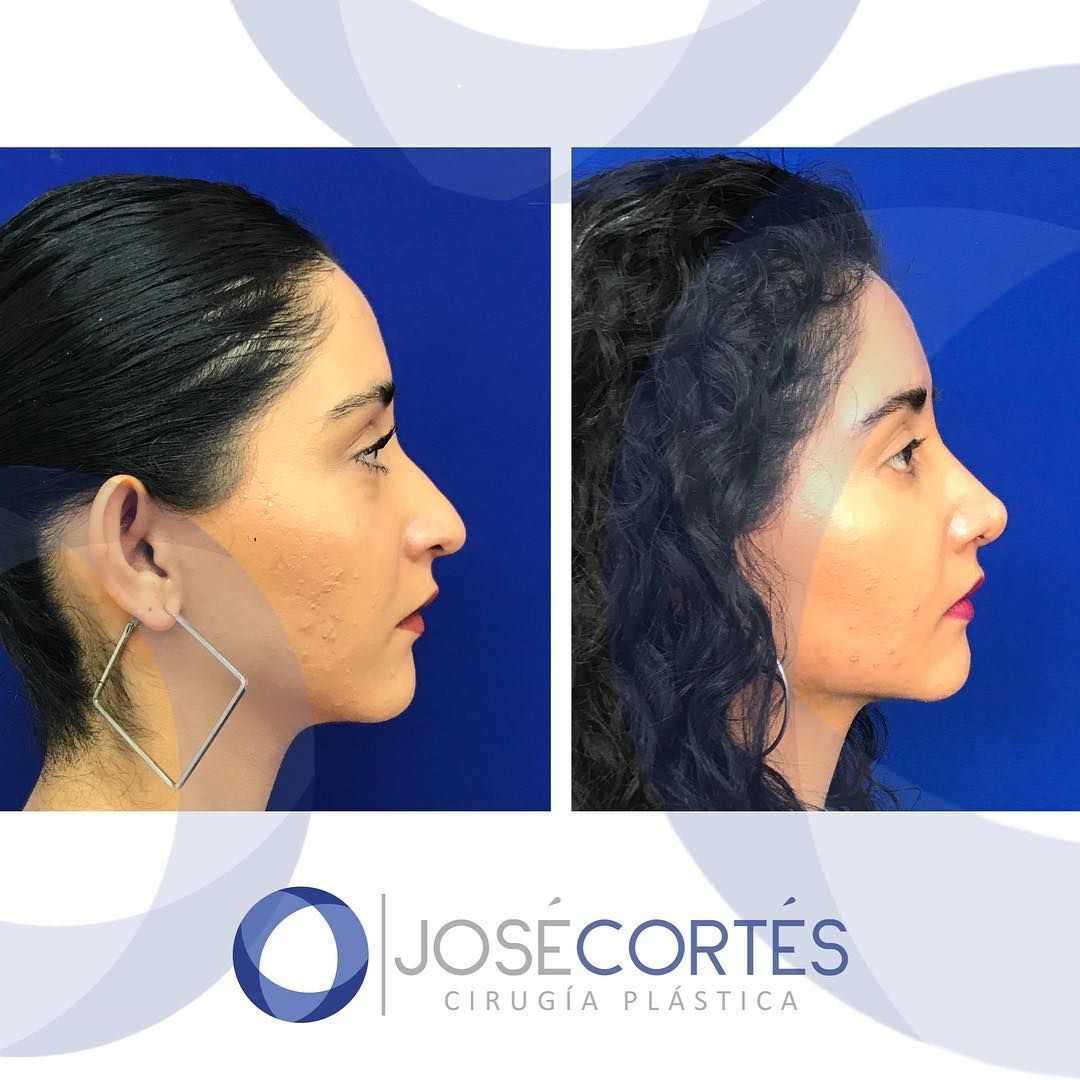 José Cortés Arreguin-23