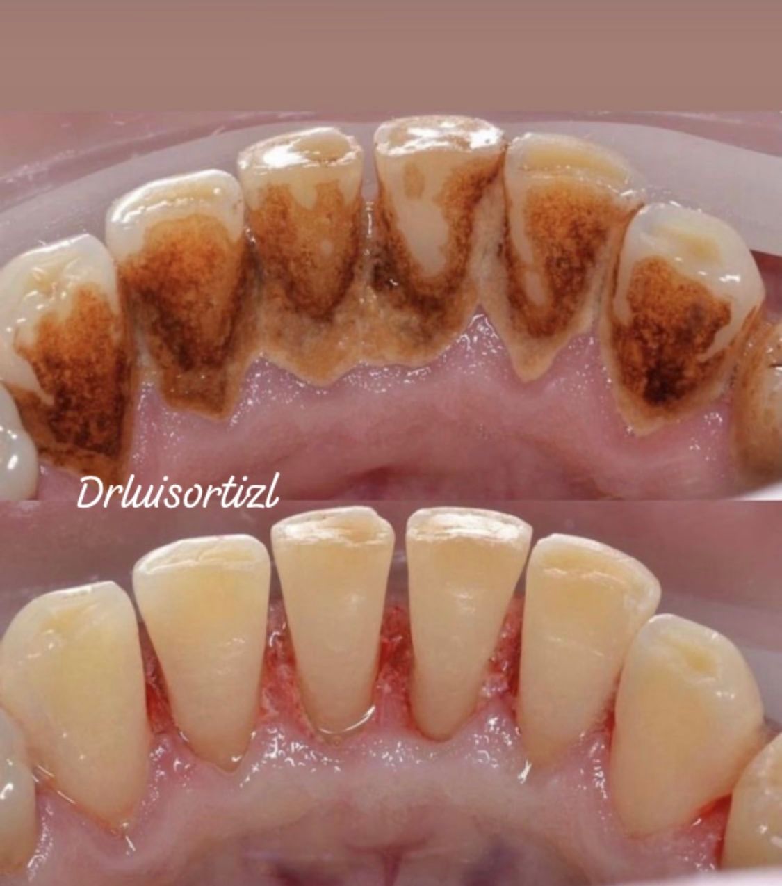 Luis Ángel Ortiz López-15