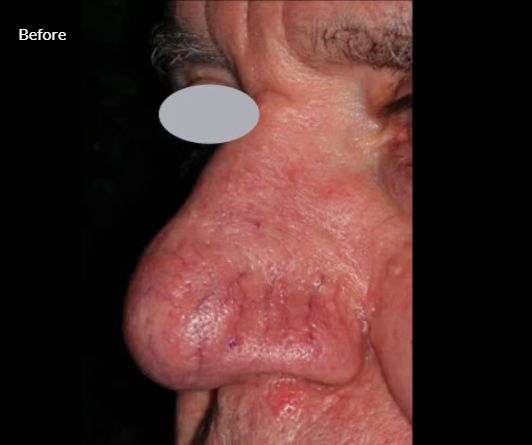 Jorge Luis Villalobos Ibarra-8