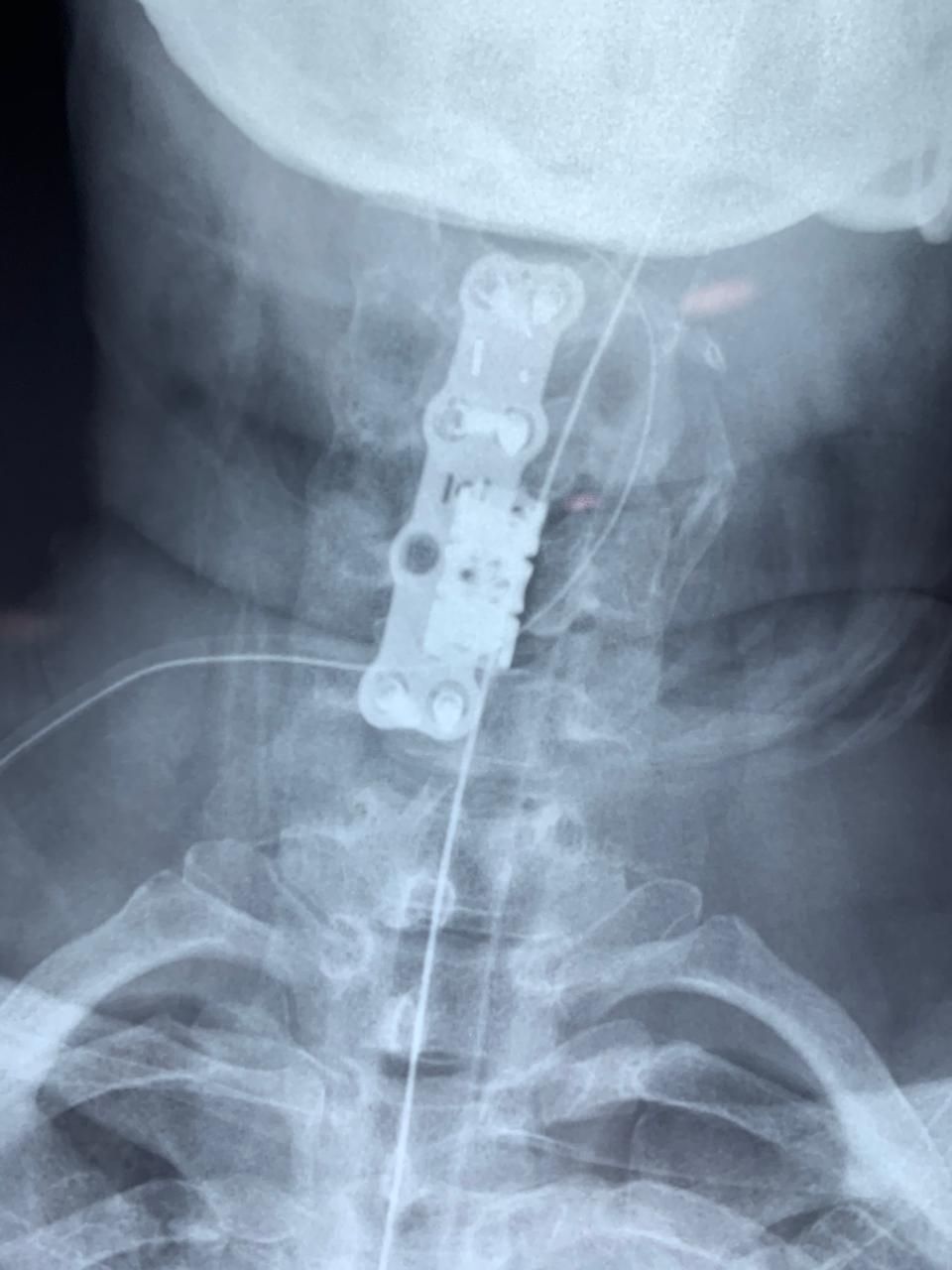 Ricardo Reyna Reynoso-2