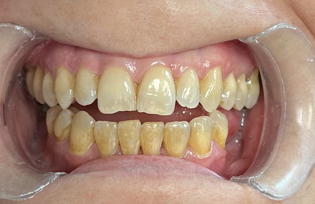 Esmeralda Candida Guerrero Pimentel-19